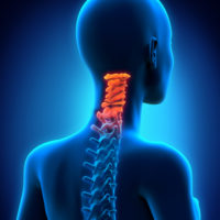 cervical trauma cervical trauma