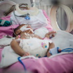Infant with brain injury Infant with brain injury