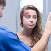 Teenage girl with a head injury .jpg.crdownload