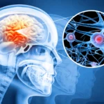 Human brain damage and treatment concept.