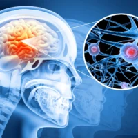 Human brain damage and treatment concept. Human brain damage and treatment concept.